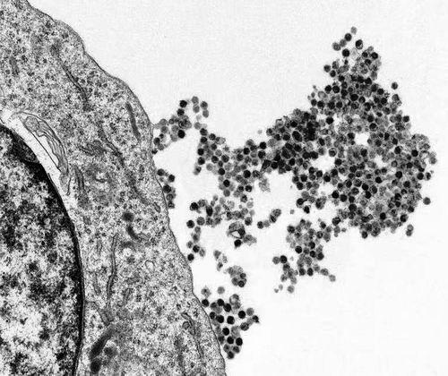 【科学家阐明常见病毒如何触发多发性硬化症】MS是一种人体免疫系统攻击脑和脊髓神经