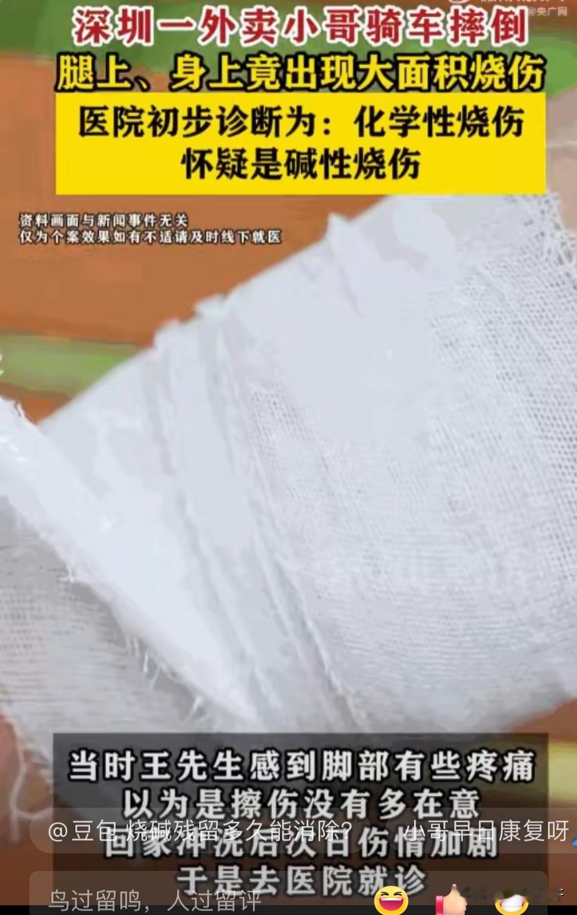 飞来横祸不由人！深圳一位外卖小哥，骑车送餐时因为路滑不慎摔了一跤，本以为只是寻常