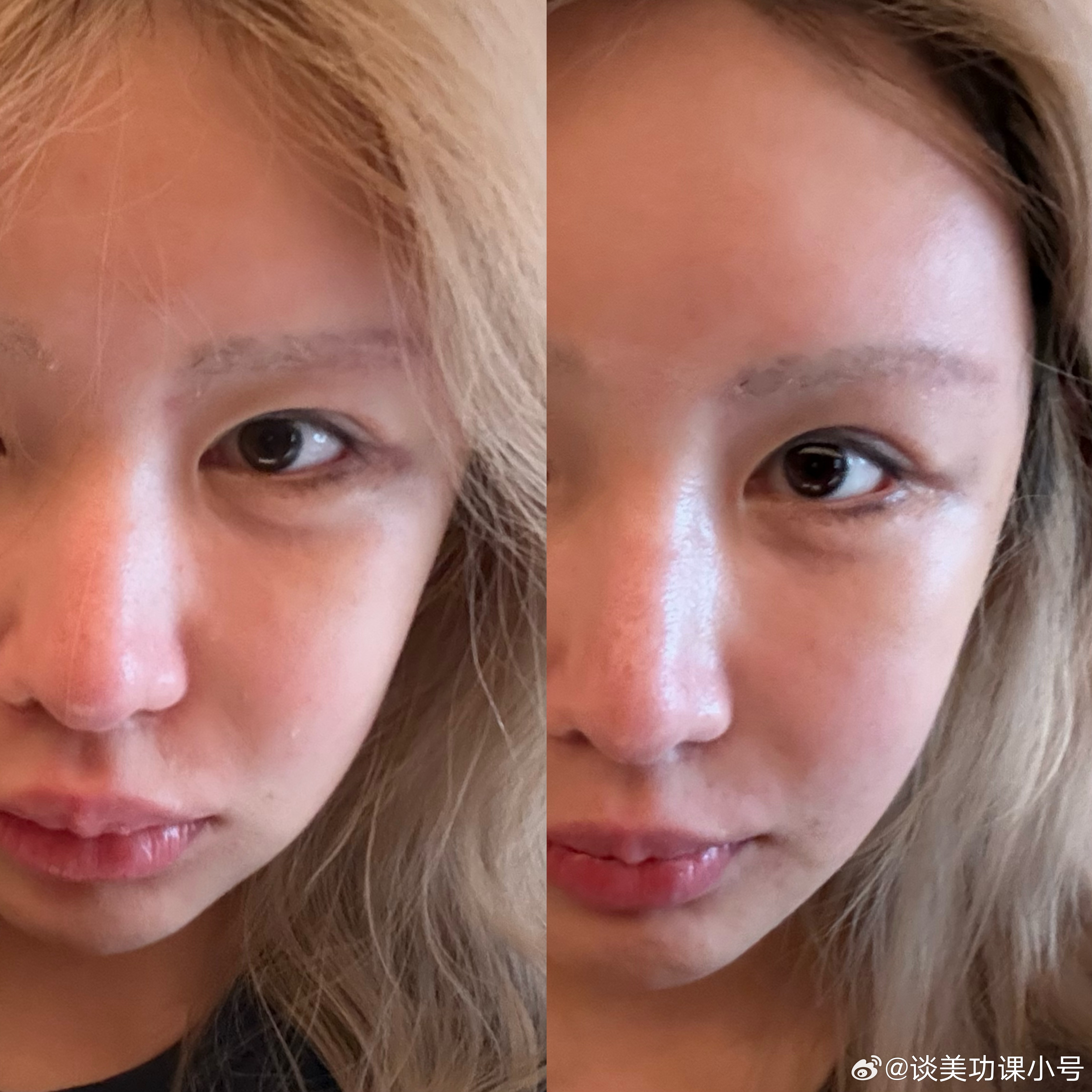 为什么说人一定要运动。上周出差我刚起床在电梯口拍的vs去跑步机跑了30min之后