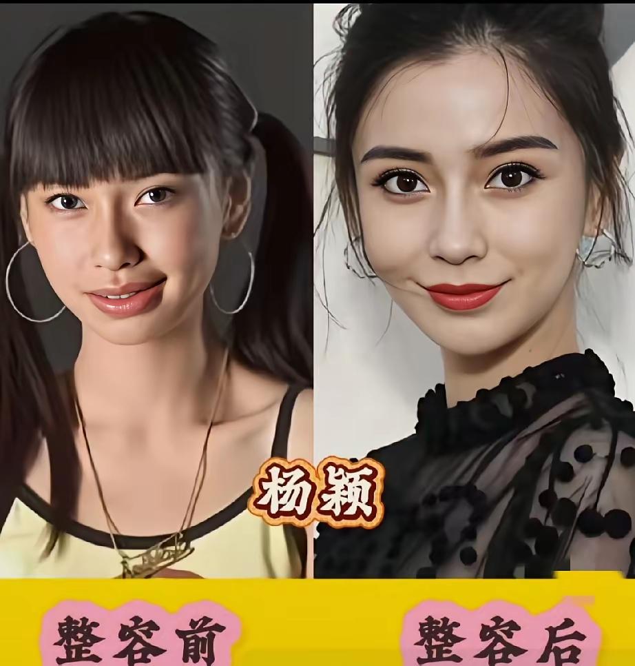 爱美之心人皆有之，
但一定不要过度。

 娱乐圈里的女演员们整容似乎早就司空见惯