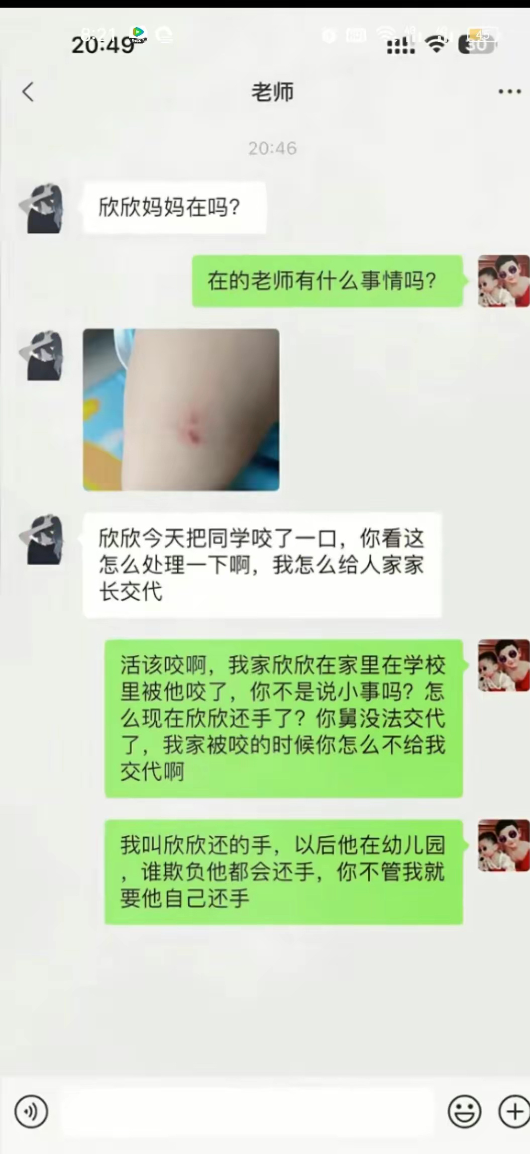 一个巴掌拍不响，都是我家孩子错吗？小孩子打架不是很正常吗？ ​​​