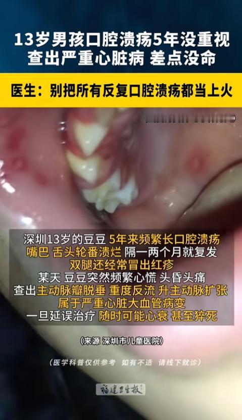 “赶紧自查！”5月26日报道，广东深圳，当地医院披露了一起案例。一位13岁的男孩