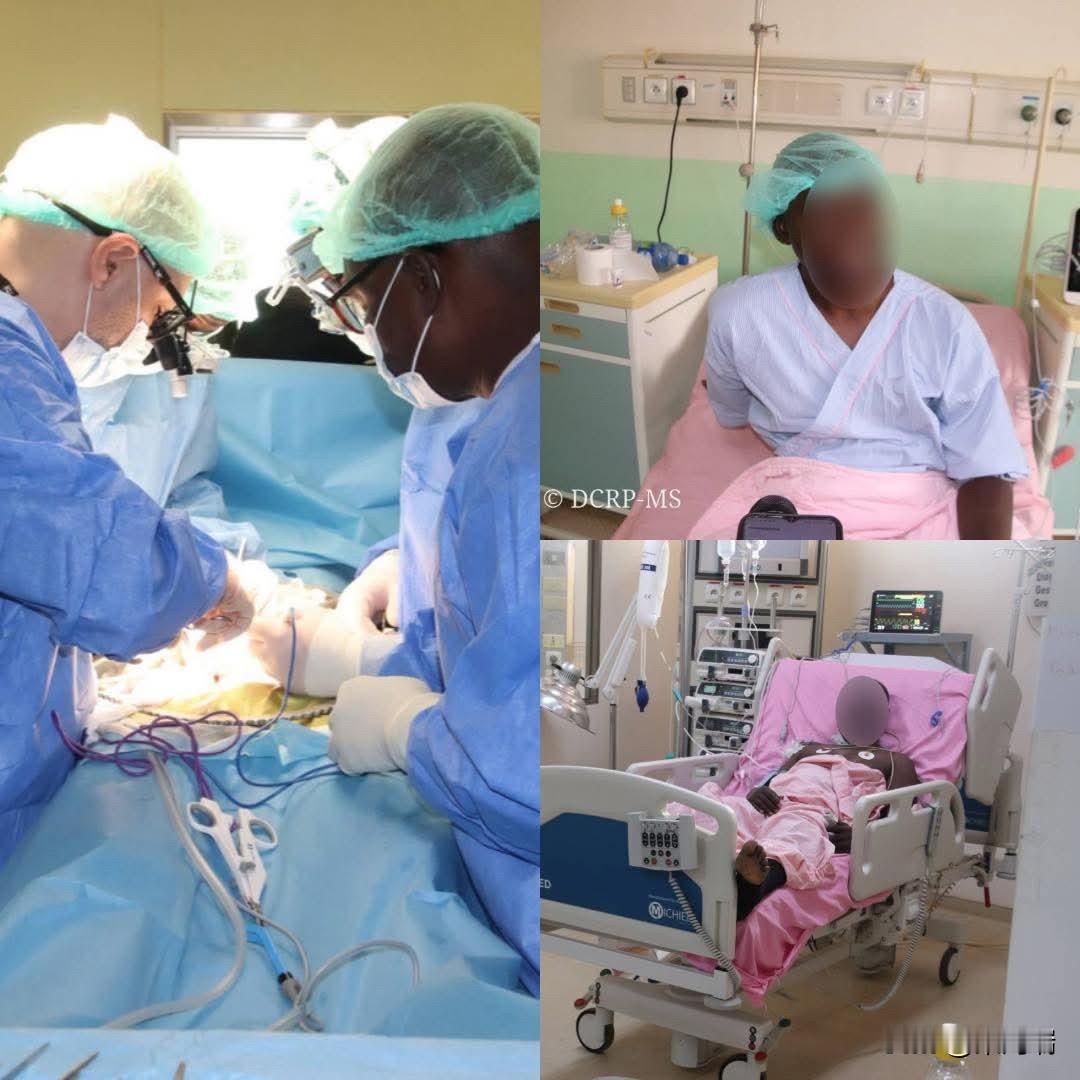 滕甘多戈大学医院成功完成了布基纳法索的第二例肾移植手术。这一消息标志着布基纳法索