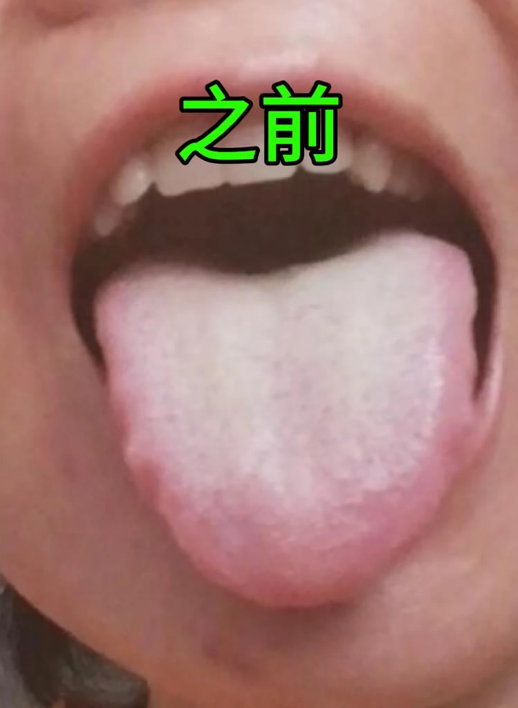 舌头其实就是 “ 身体健康 ” 的另一面镜子
 
看下面这个图片，这是一位粉丝朋
