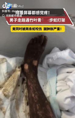 电视剧都不敢这么演！安徽，一男子傍晚散步时，偶遇竹叶青和五步蛇打架，不料，当他从