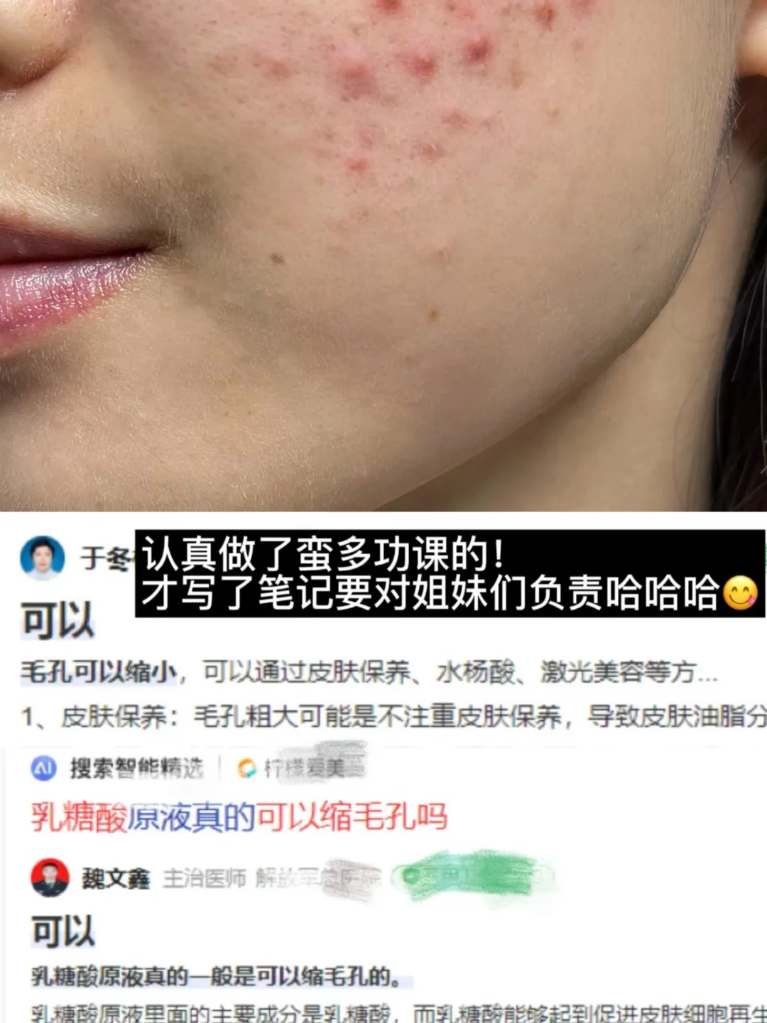 频繁打水光的代价就是......