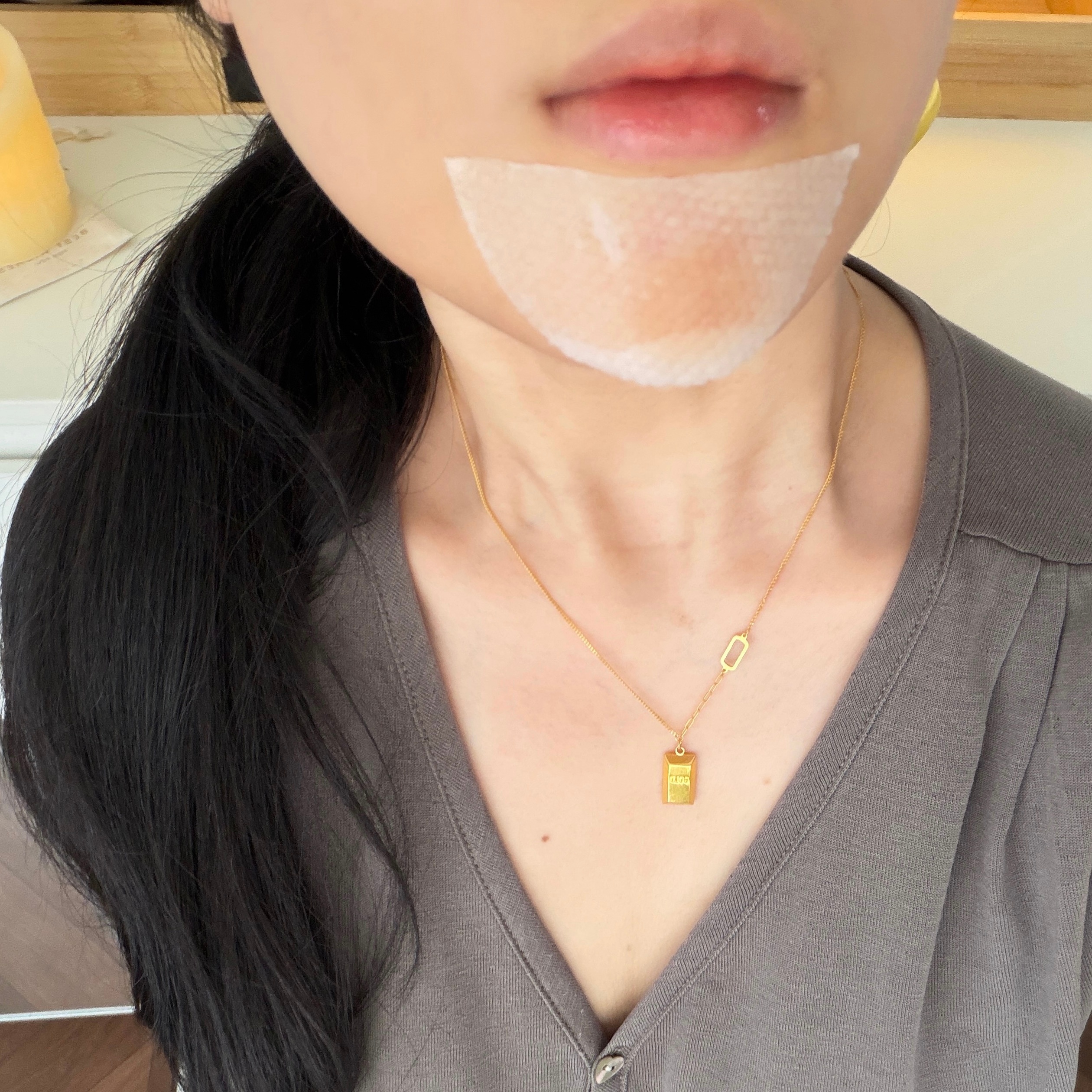 又到了一月一次整治下巴阴湿大肿痘的时候厚涂芙清再湿敷姜黄棉片 下去挺快的 敷的时