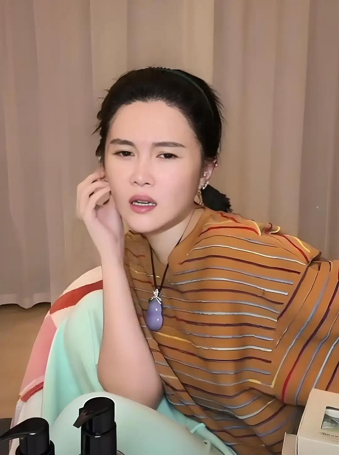 这事儿，挺让人意外的。

镜头前，赵本山女儿球球瘦到脱相，脸肿得明显。她平静地自