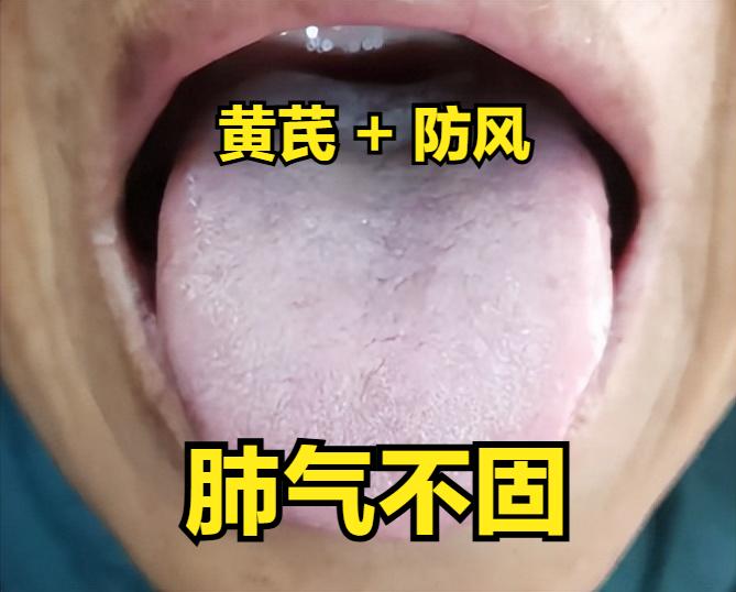 黄芪补气不盲目，3 个黄金搭档，虚汗、乏力、气喘全赶跑！

1. 黄芪 + 防风