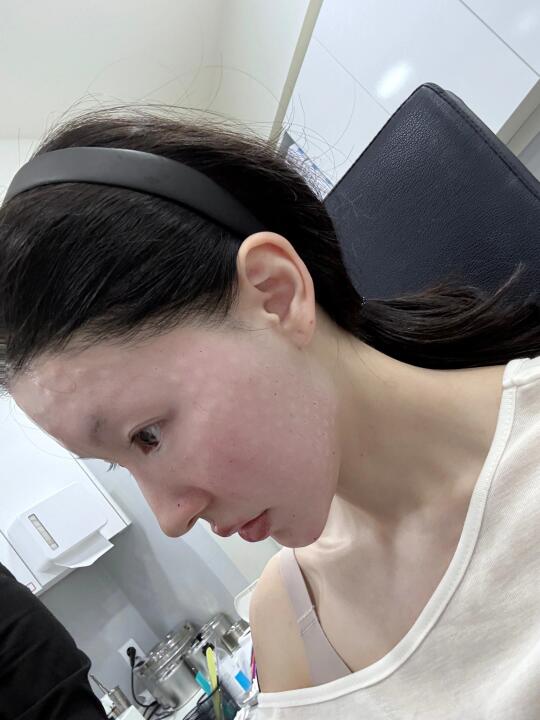 🇰🇷到底是谁发明的黑盒丽珠兰，如果没有用