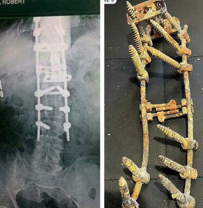 这就是普通人生活的真相：用命换钱，再花钱保命。💸
今天在朋友圈看到这张图，心里