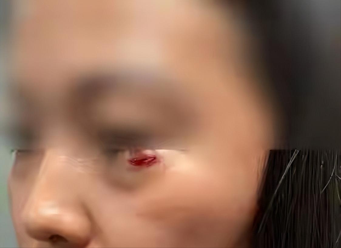 黑龙江齐齐哈尔，K549次列车上，闫女士躺下铺闭目养神。突然"啪"一声，上铺一部