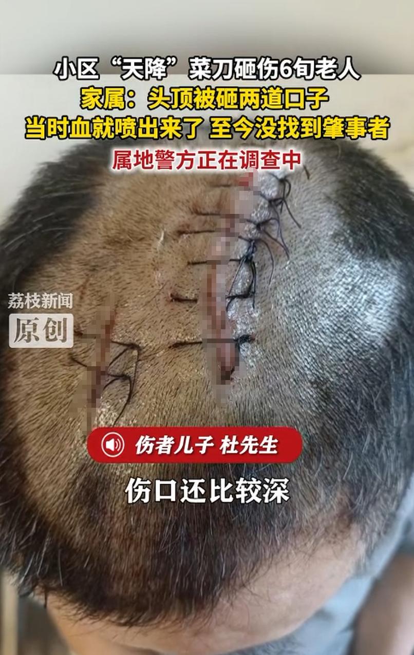 必须严惩到底！湖南张家界，一位 65 岁大爷正待在自家二楼露台上歇口气，打算好好