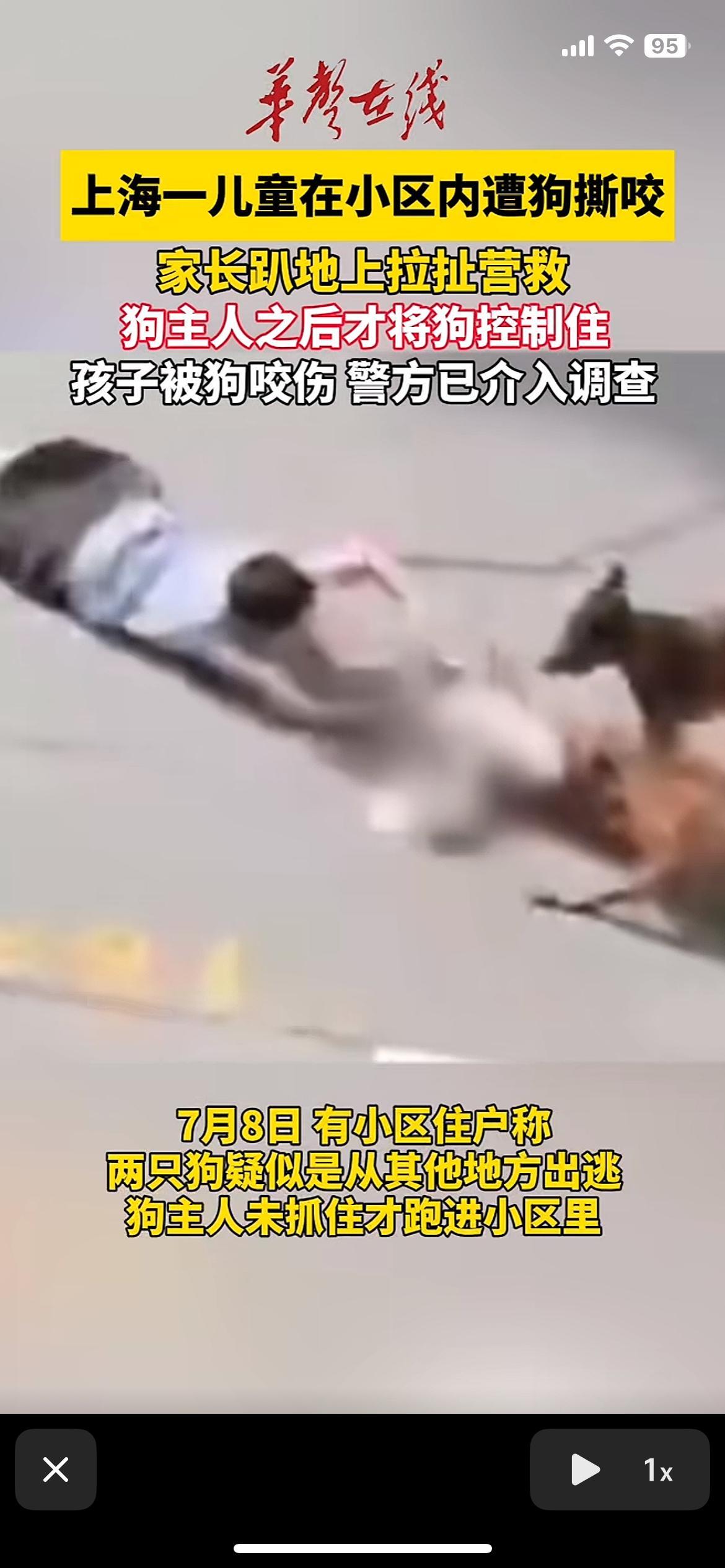 上海一儿童小区内遭狗撕咬小狗太小，不用栓 ！大狗性格温顺，不用拴！从来没有咬过人