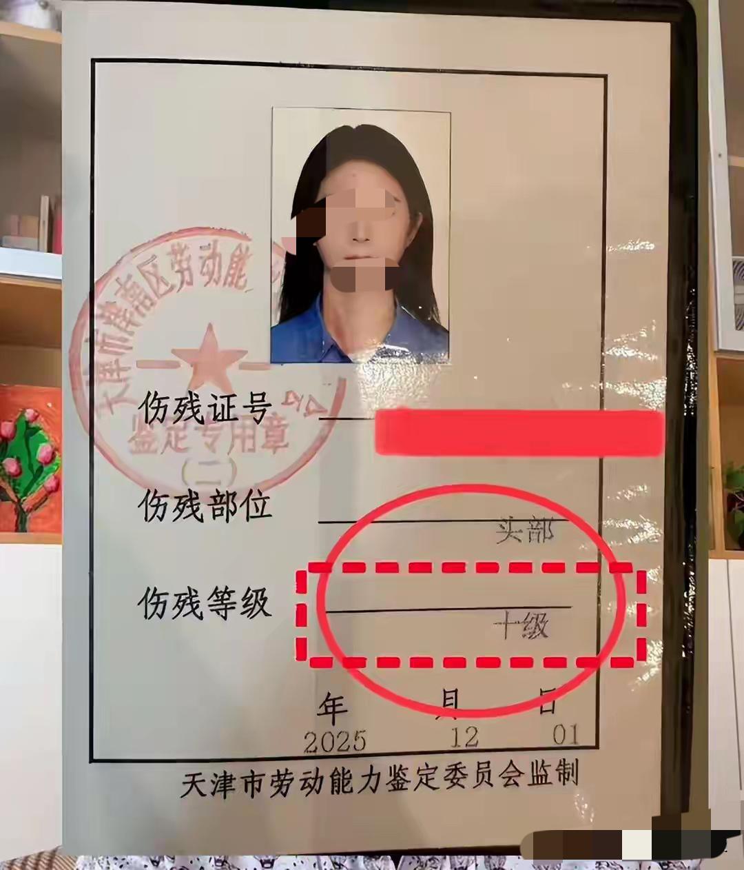 恭喜，恭喜丽丽拿到了工伤十级伤残国家证书。
     丽丽发文经过80天的努力，