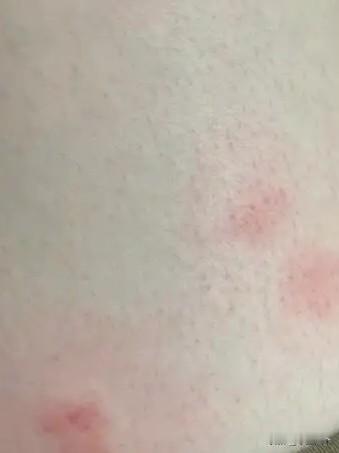 今年夏天除了被蚊子叮一次，其余日子几乎没见到蚊子，感觉都热死了，但是出伏之后，感