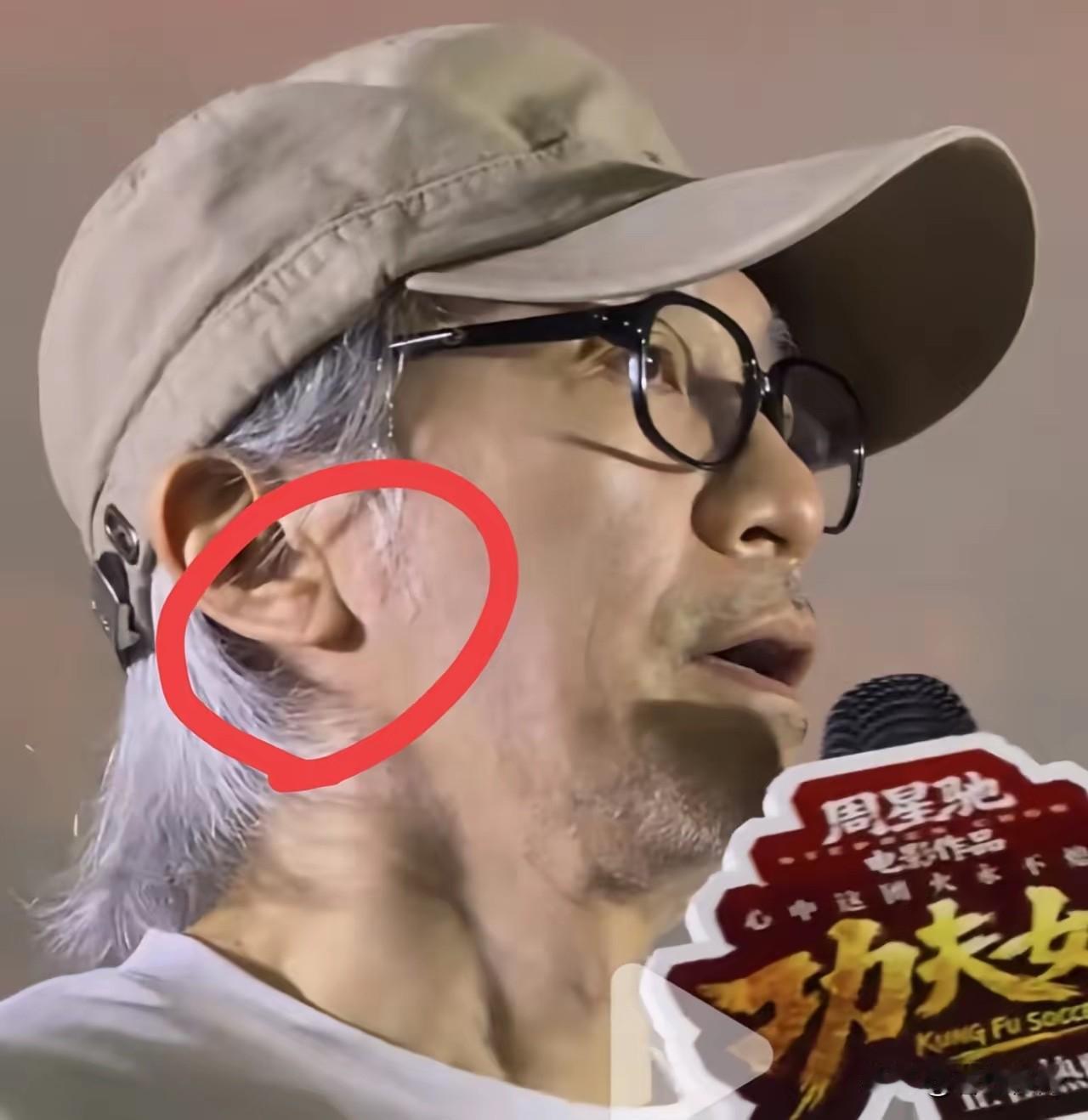周星驰接下来应该不会拍电影了吧？
眼尖的网友发现，
周星驰耳朵上的一个细节，上面