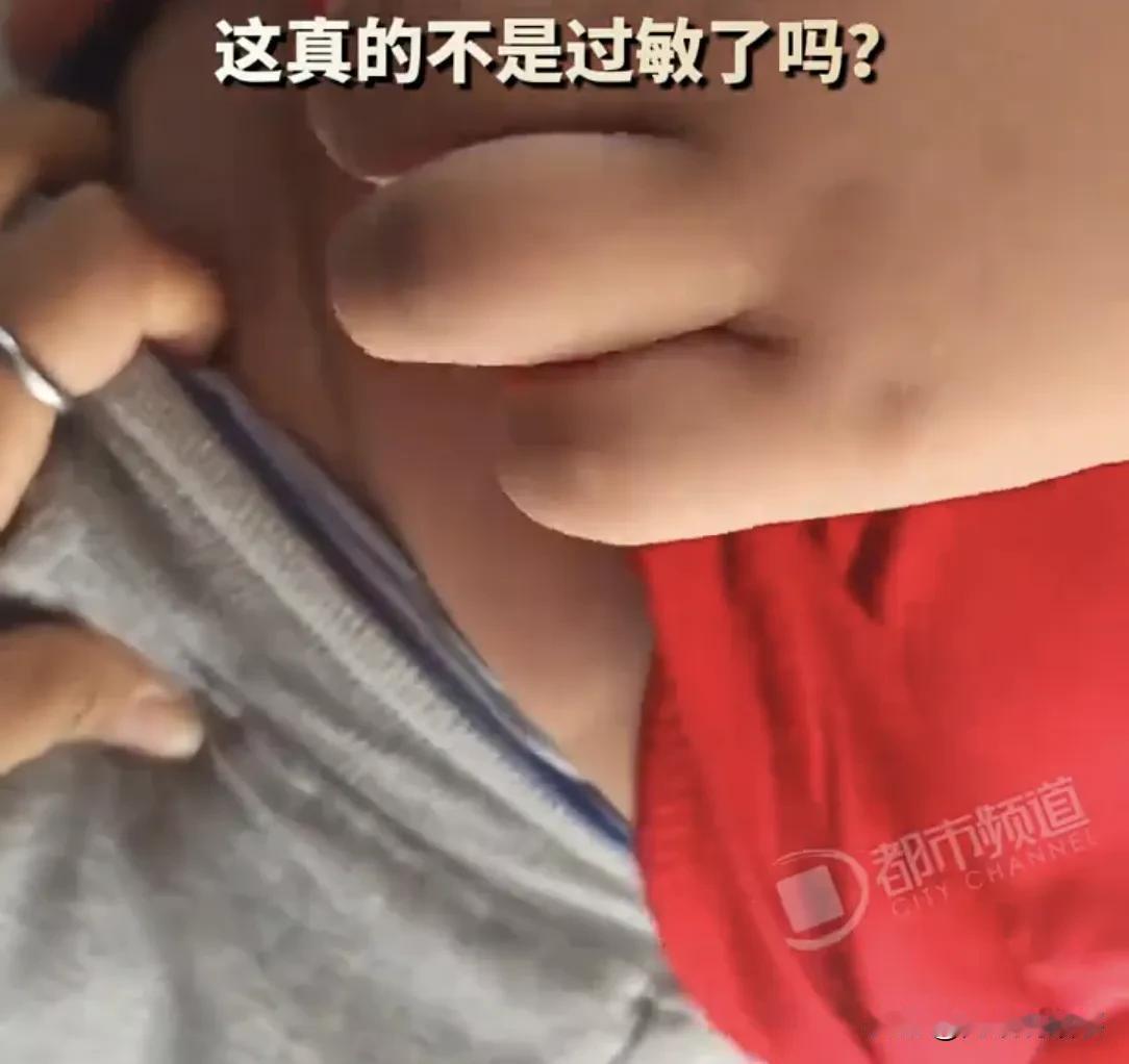 6岁男孩突然跟妈妈说肚子疼。宝妈掀开孩子衣服一看，吓得愣住，肚子上竟鼓起一个巴掌