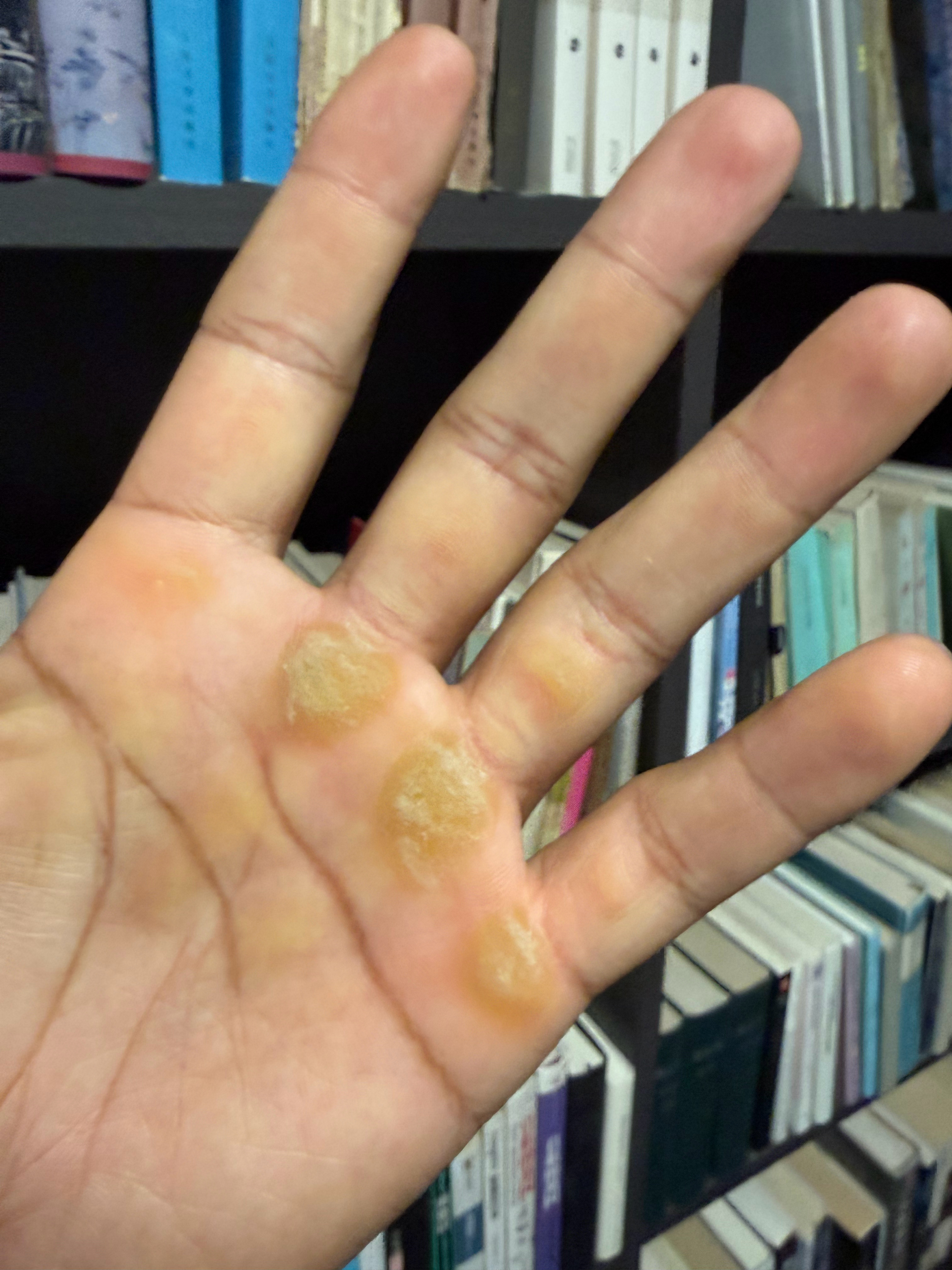 跳绳｜第1767天今日1000个 累计2034501个CrossFit｜第890