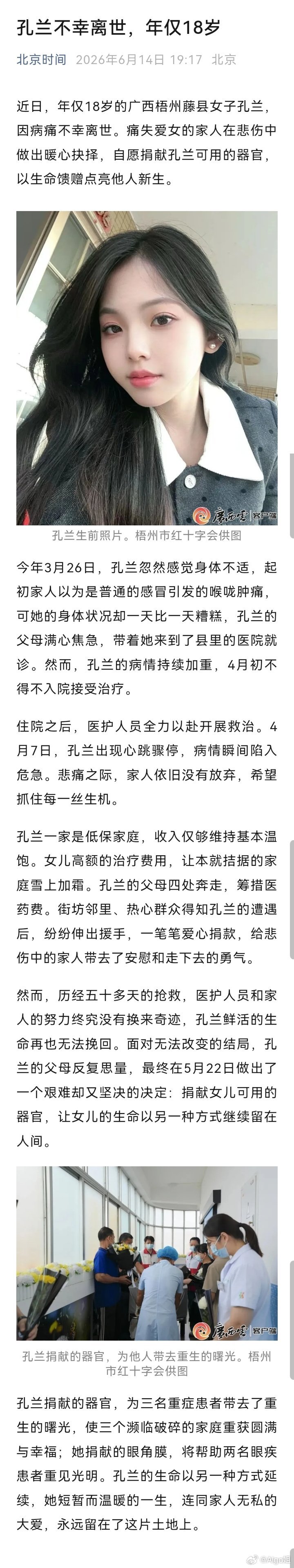 不点评 还这么年轻，又是家人做主的器官捐献。“孔兰一家是低保家庭，收入仅够维持基