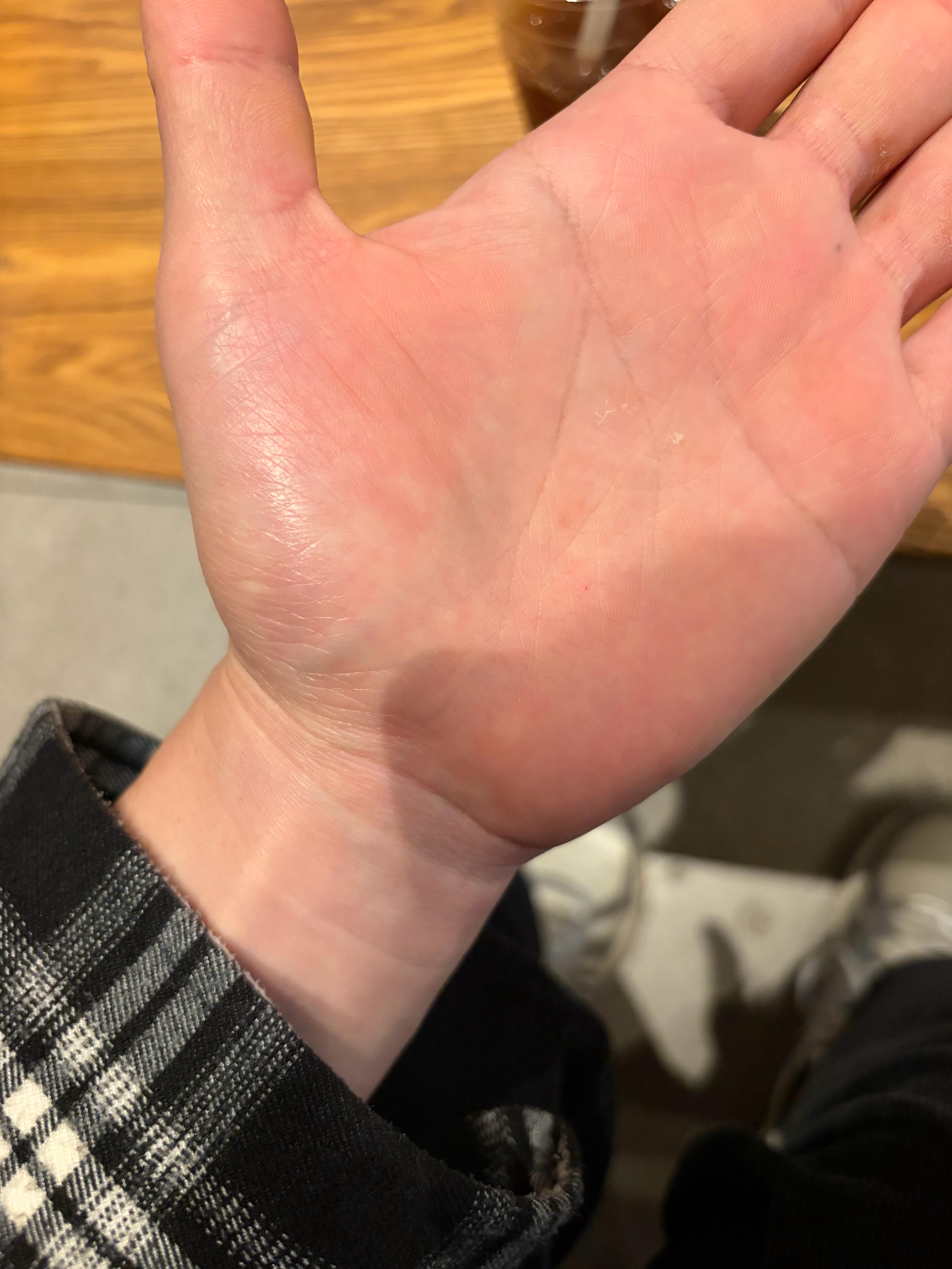 坚持了四年早睡早起，坚持了一年走路散步的大彬子，这气色是不是还可以？此人的气血强