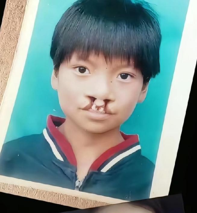 原来在我们不知道的时候李亚鹏帮助了这么多唇腭裂的人，现在那些人为了帮助李亚鹏纷纷