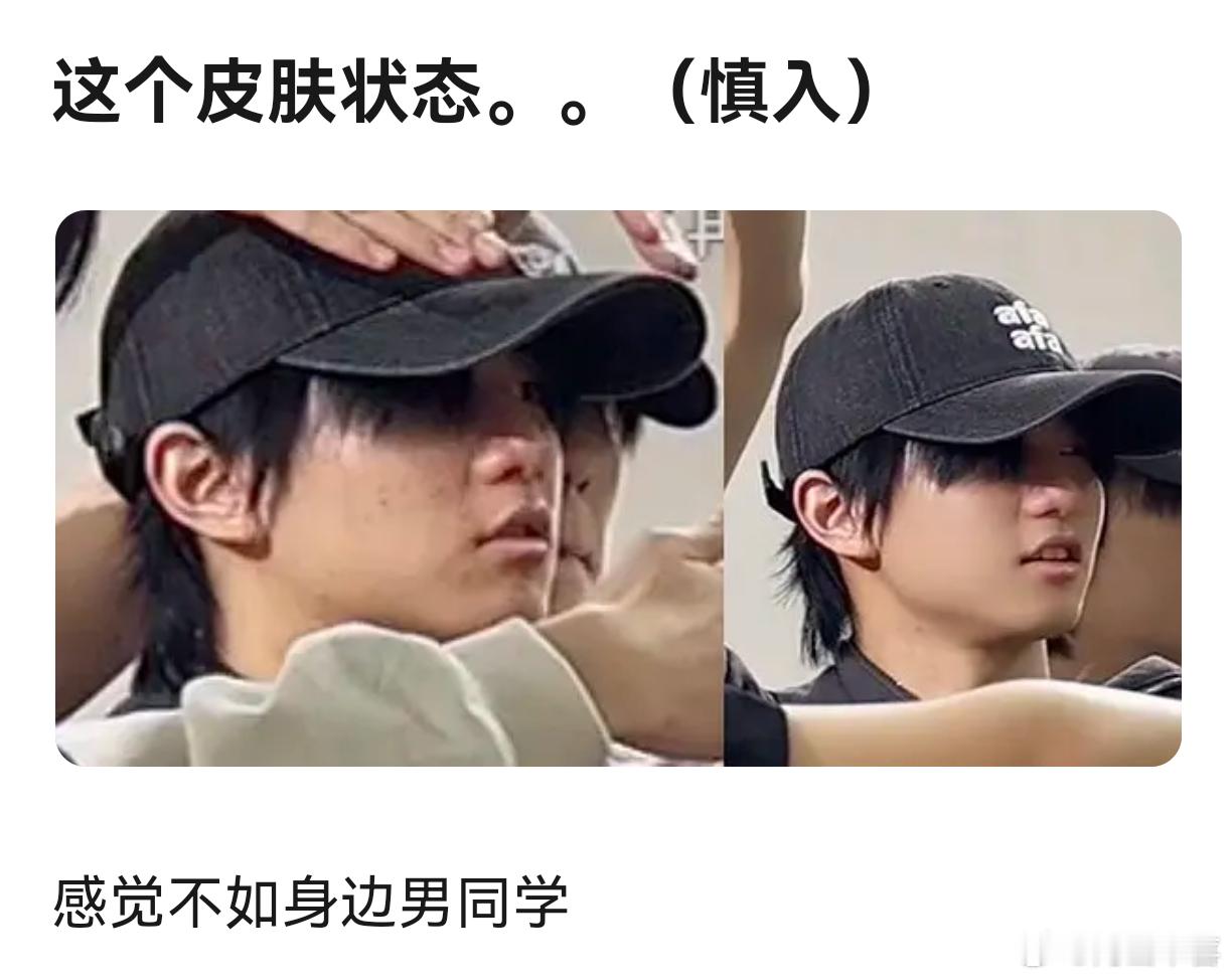 时代峰峻还橹穆镜头男豆能不能注意点皮肤管理，尤其是三代，已经看见好几个皮肤特别差
