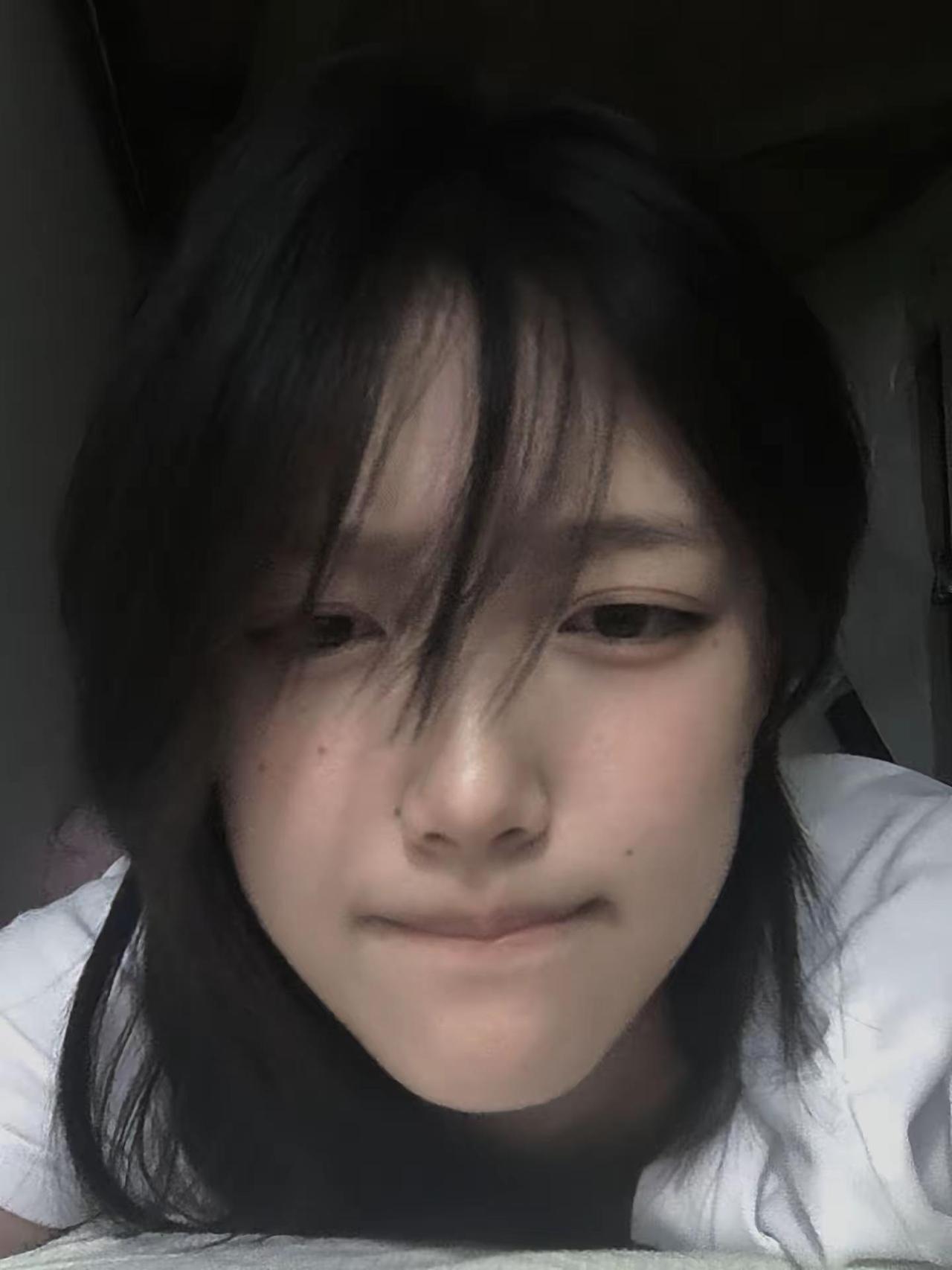 鼻基底塌陷给我滚蛋呀fyp