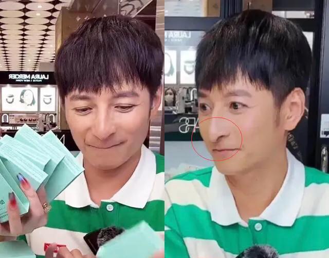 李维嘉真是瘦得“脱相”了，瘦弱的脸上配上这鹰钩鼻，看着感觉太“突兀”了！