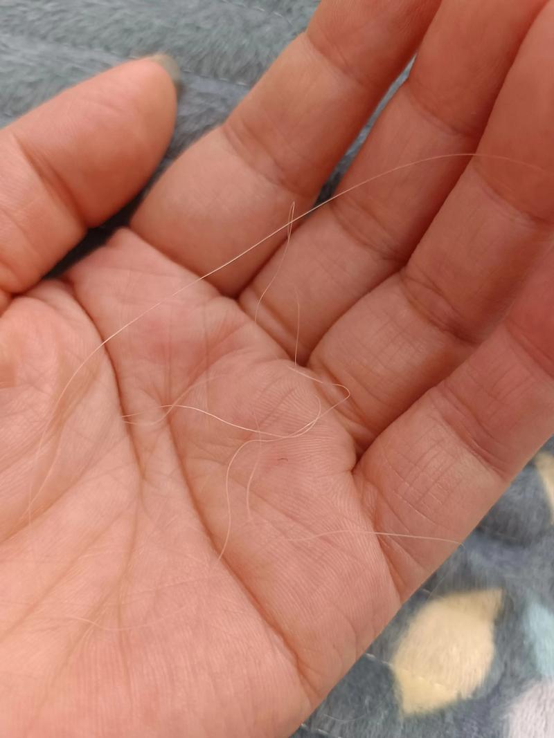 在高中的时候，有次洗头发现自己长了白头发，从一两根到后面发现越来越多，到现在的花