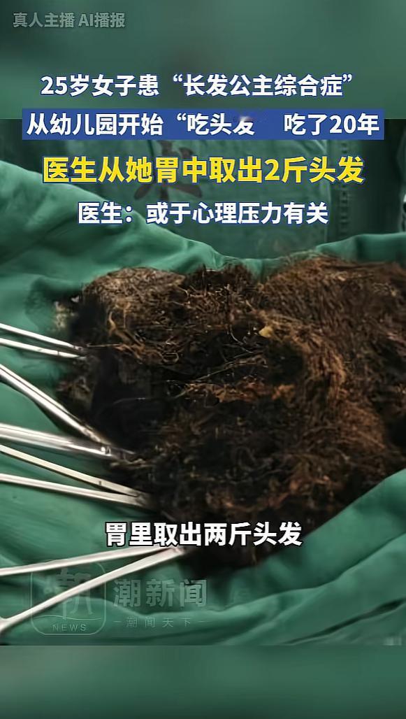 “悲剧还是发生了！”12月25日，浙江杭州，一女子从幼儿园开始就喜欢吃头发，这个