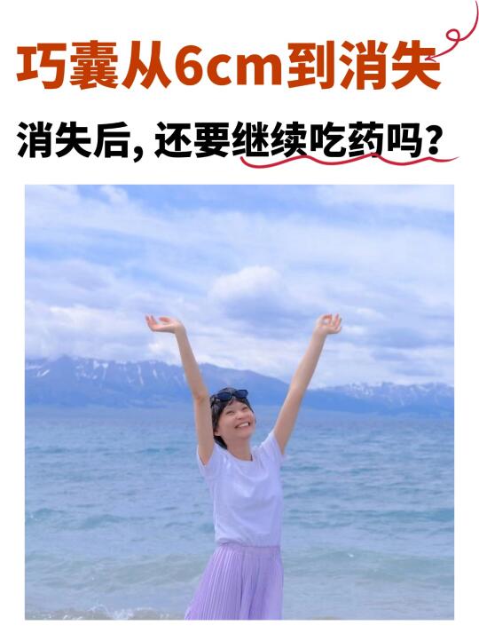 想停药必看！巧囊消失后我没停药，记这3点