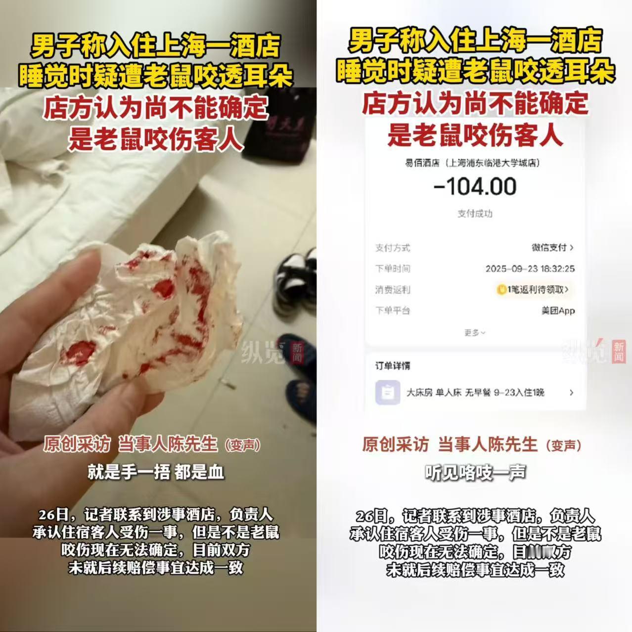 一上海大哥倒大霉了！

住酒店睡个觉，耳朵直接被不明东西咬透出血，开灯连影子都没
