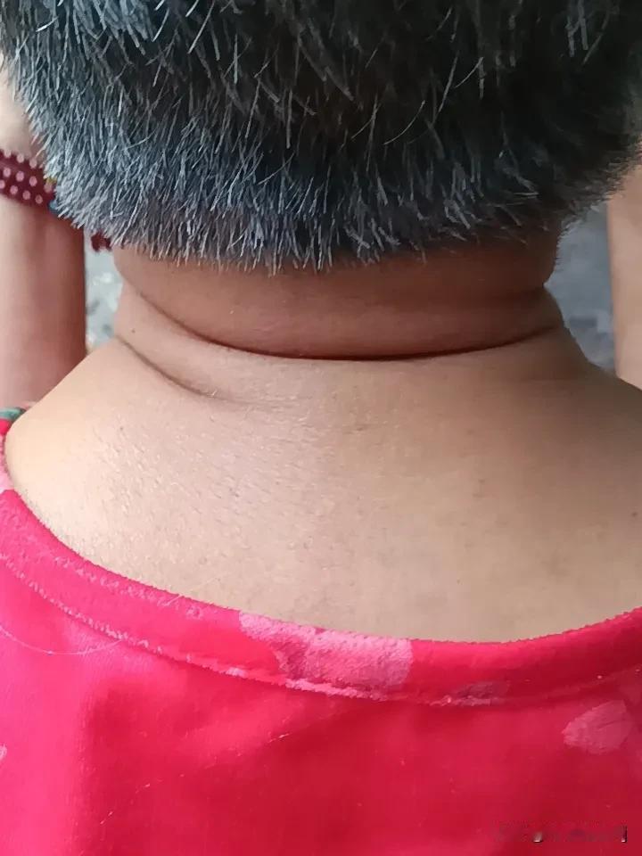 颈椎病为什么会头疼？
颈椎本身就是给头部输送气血的关键通道，一旦曲度变直、肌肉僵