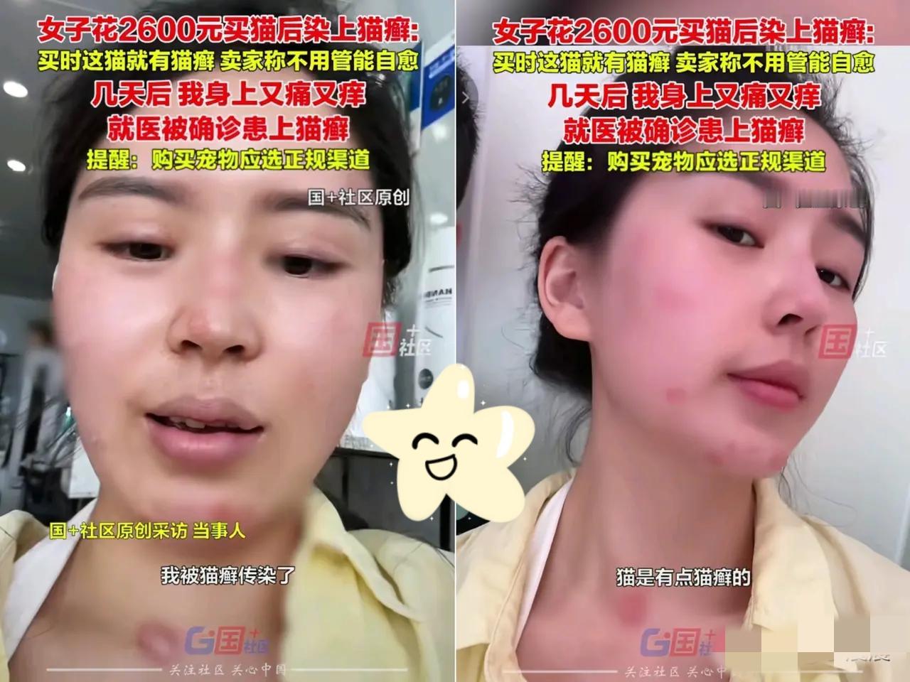 崩溃了！
 
嘉兴女子花2600块买猫，明知猫带癣还信卖家“能自愈”，结果自己满