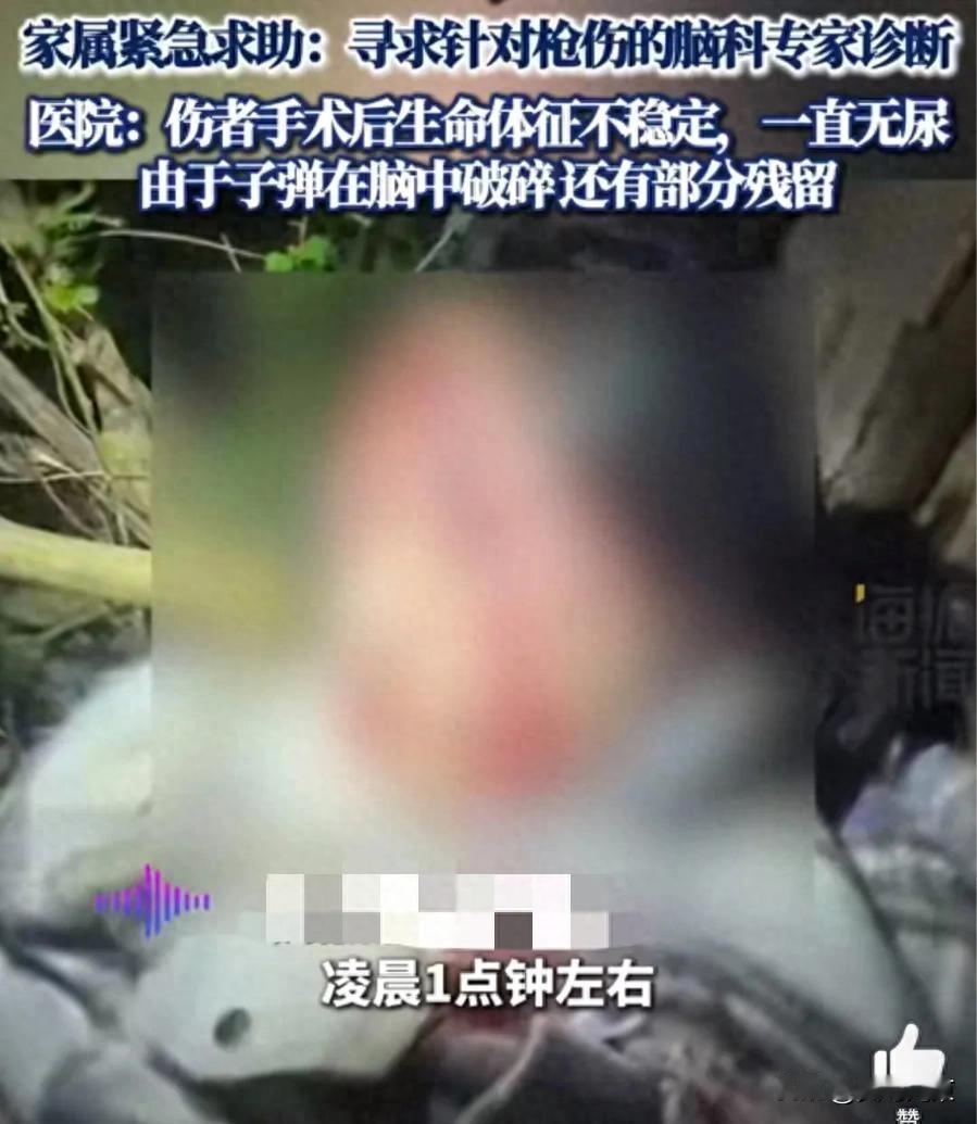 安安徽18岁少年下班途中被气枪打中 医院回应：深度昏迷 生命体征不平稳
10月2