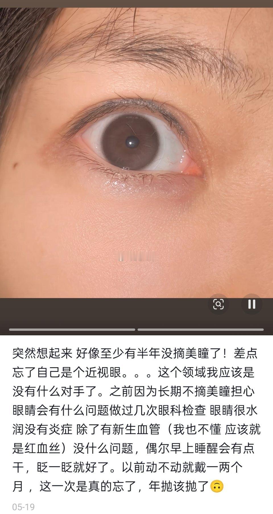 被这个评论区吓死了，我戴美瞳超过一天我都觉得我会瞎，他们居然能按月和年戴，眼睛还