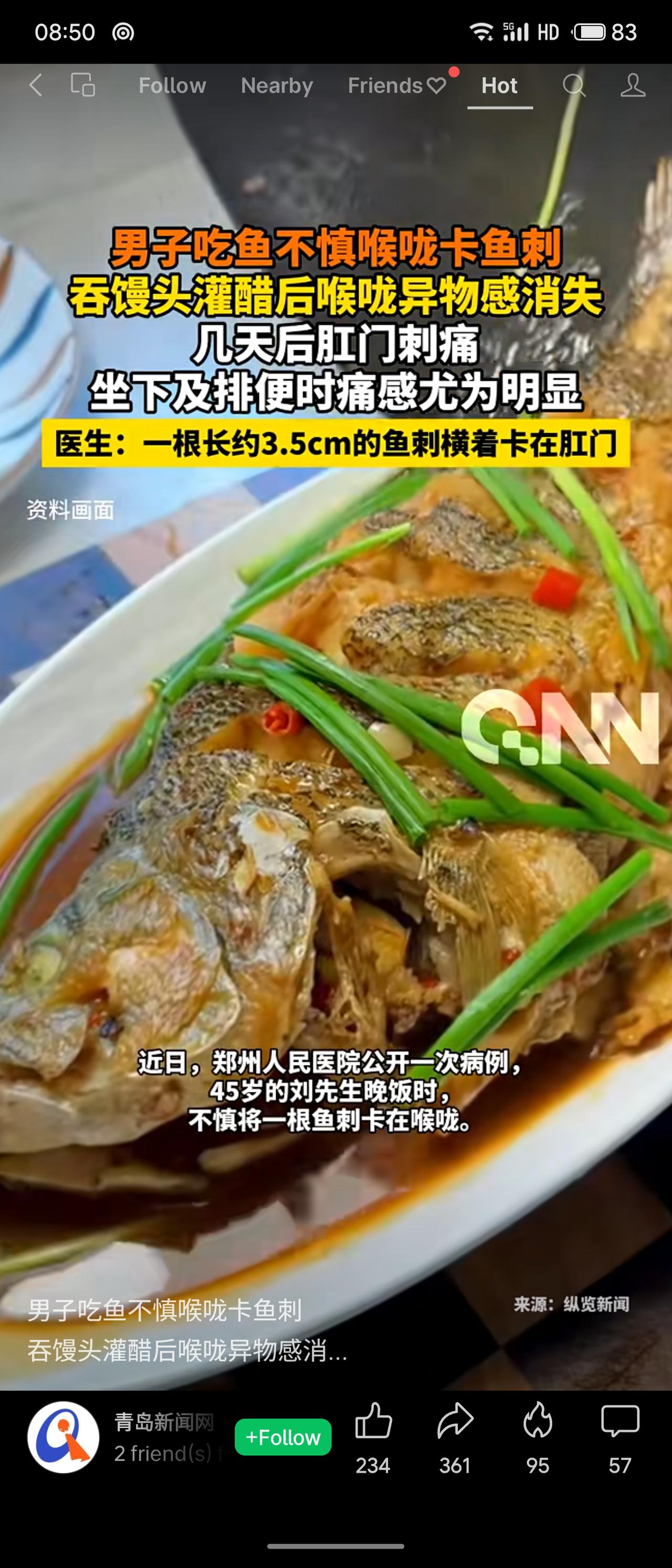 一名男子吃鱼时喉咙卡刺，采用吞馒头、灌醋等错误方法，不适感暂时消失。几天后肛门剧