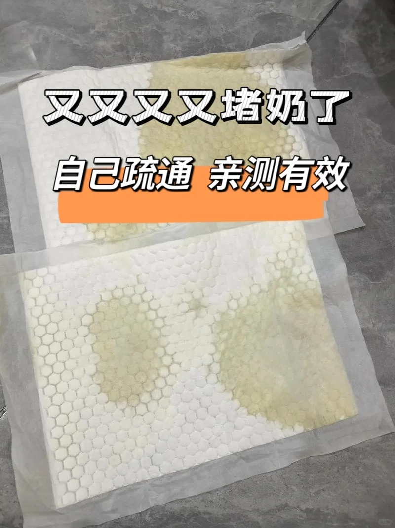 哺乳期堵奶，百试百通自救方法！亲测有效！