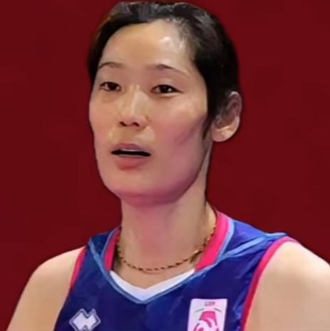 终于知道
朱婷为何迟迟不回国家队了
1.伤病困扰:
手腕旧伤需要控制比赛训练负荷