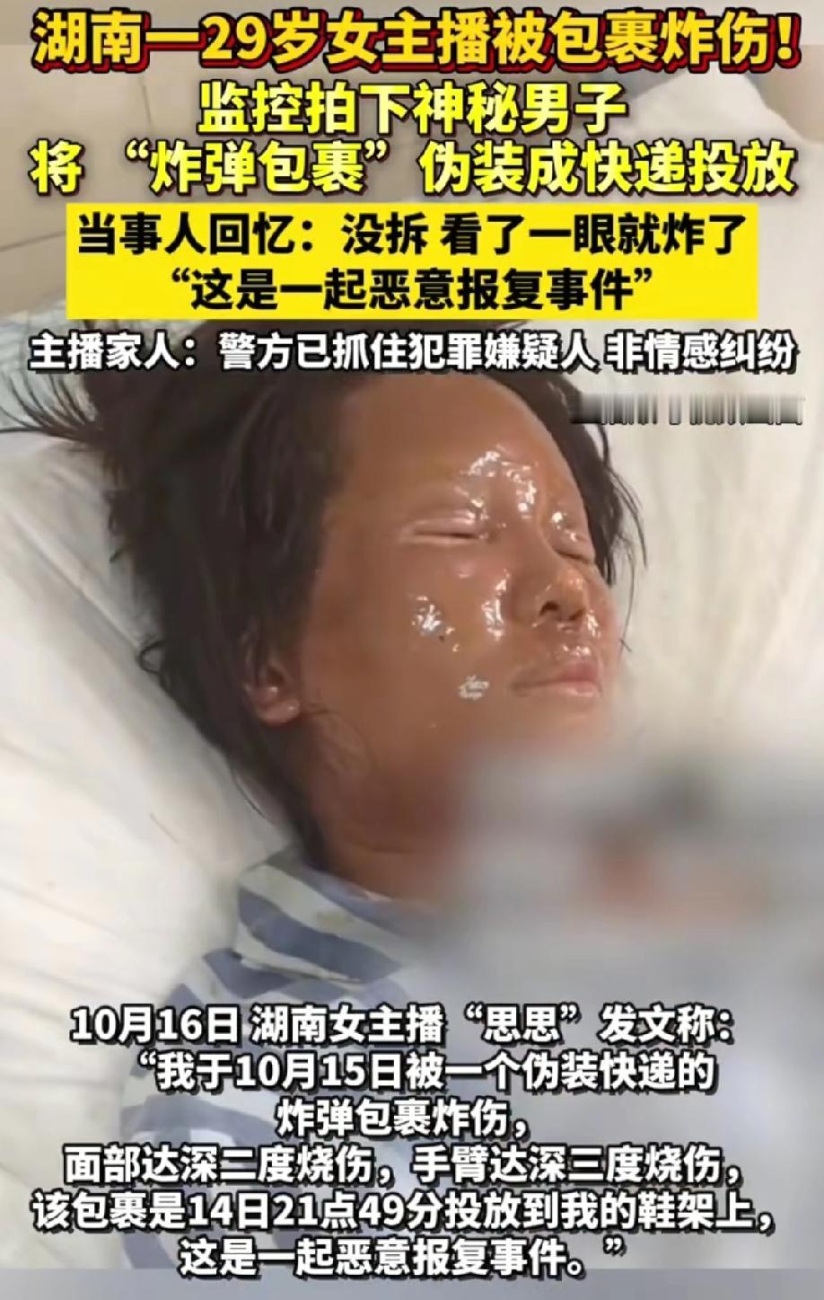 万万没想到
29岁的女主播被一个包裹炸伤面部
仅仅是好奇拿起来看看一眼，拆都没拆