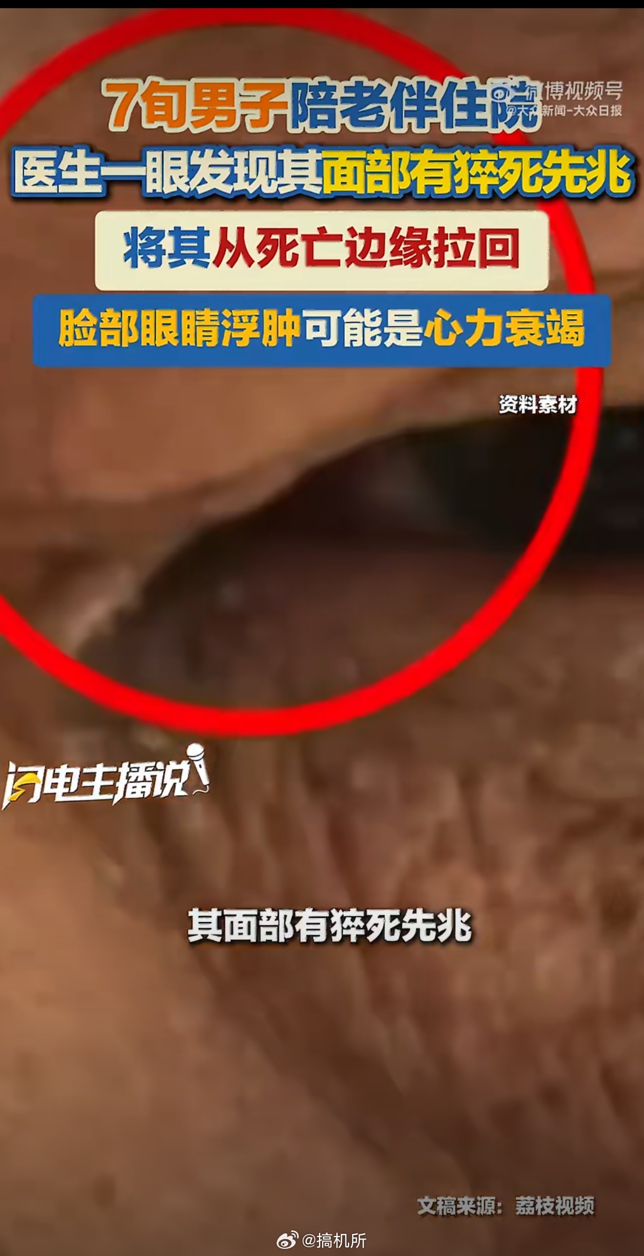 男子陪家人看病被医生发现猝死先兆幸亏医生经验丰富，这才捡回一条命，换作其他医生可