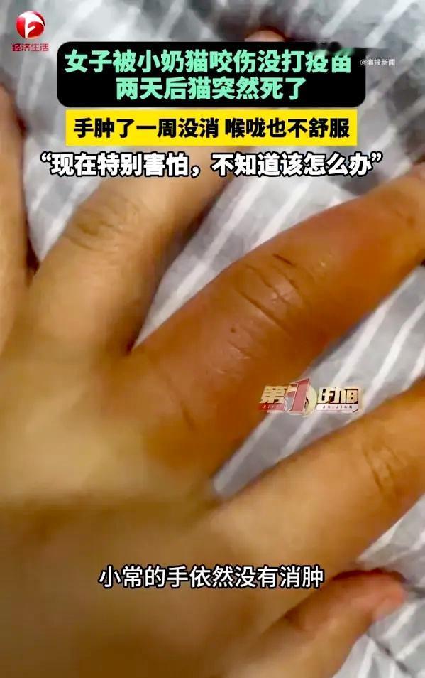 心存侥幸心理要不得！10 月 29 日消息，河南开封一名女孩左手被幼猫抓伤咬伤，
