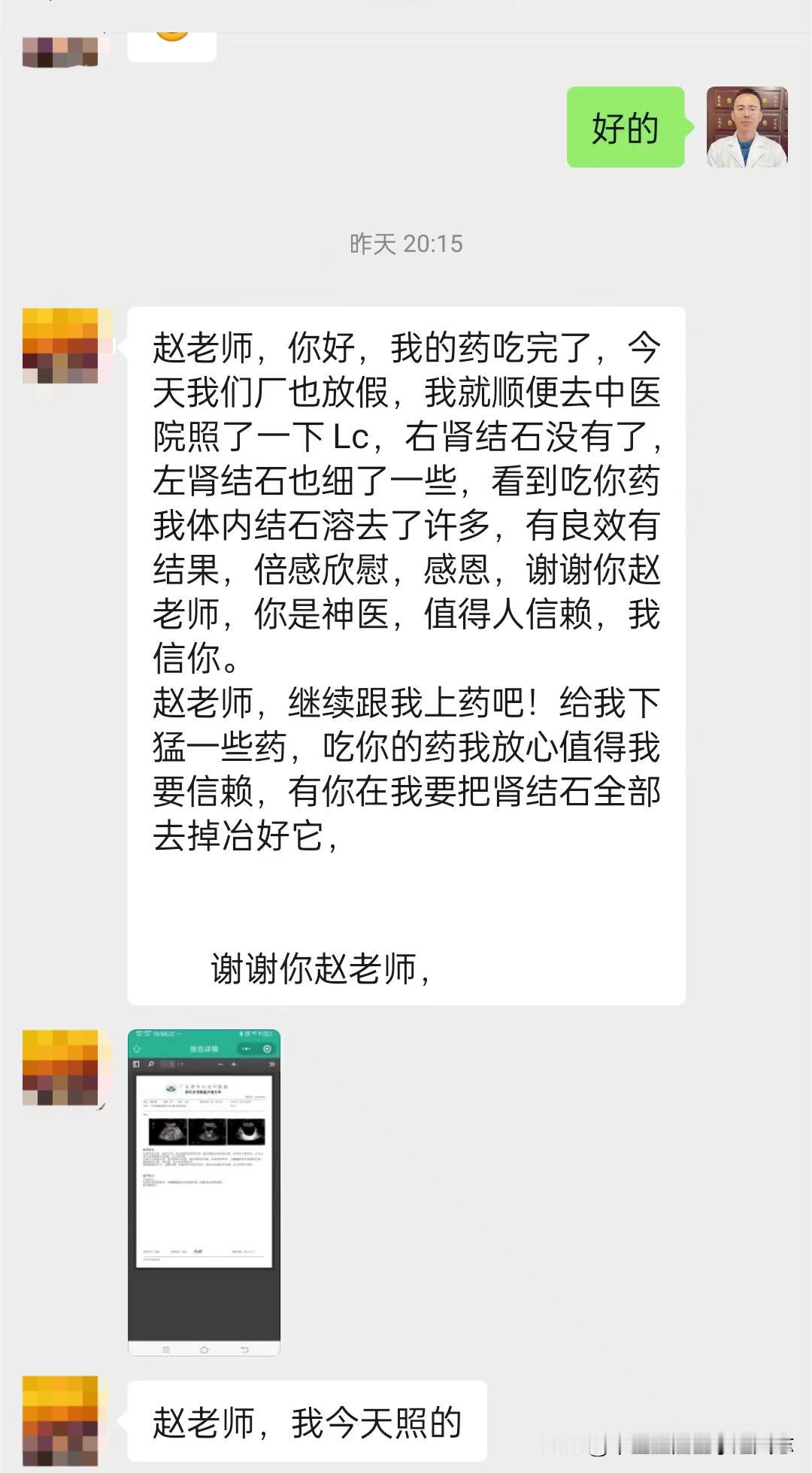 肾结石患者送来喜报，右肾结石没有了，左肾结石小了