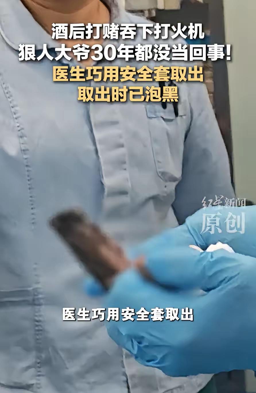 见过狠人，但没见过胃里揣打火机30年的狠人！
 
1991年酒局，大爷跟人赌“你