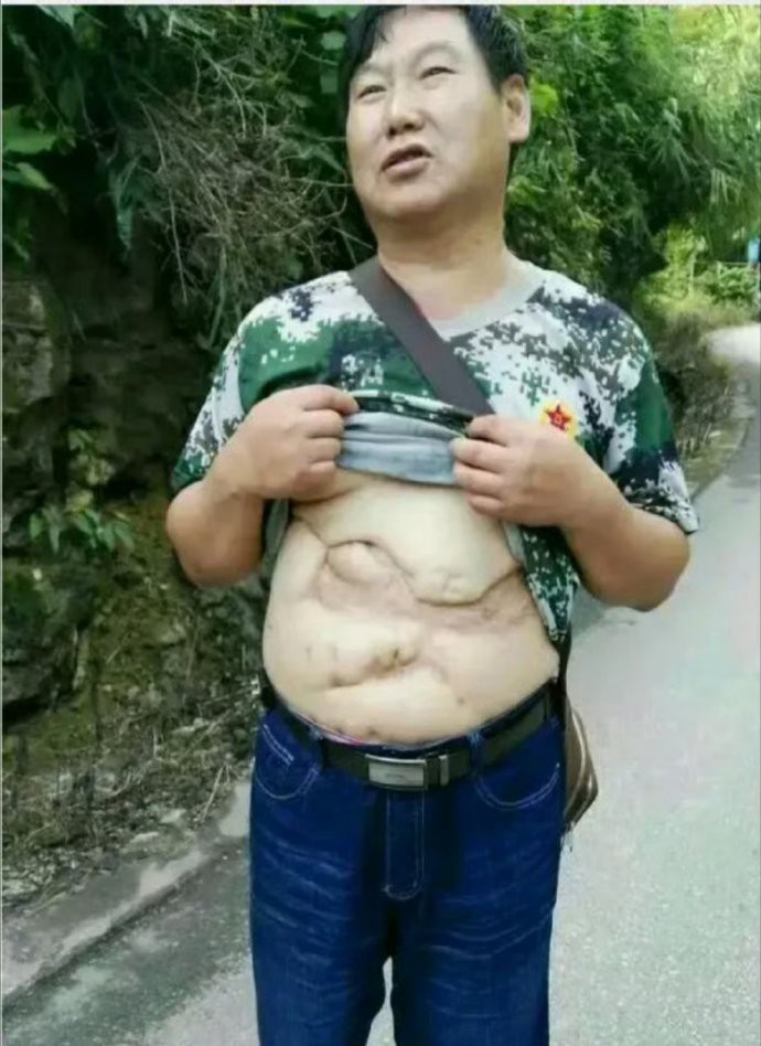 他把衣服掀起来的那一刻，肚皮中的地图让人感到震撼！他就是老山某炮团二营副营长，战