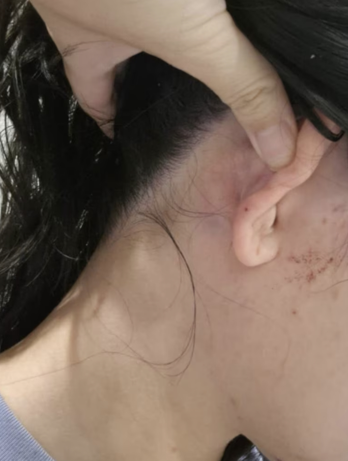 #驻澳使馆回应中国女子堪培拉遭殴打#【使馆回应中国女子在堪培拉遭陌生人殴打：要求