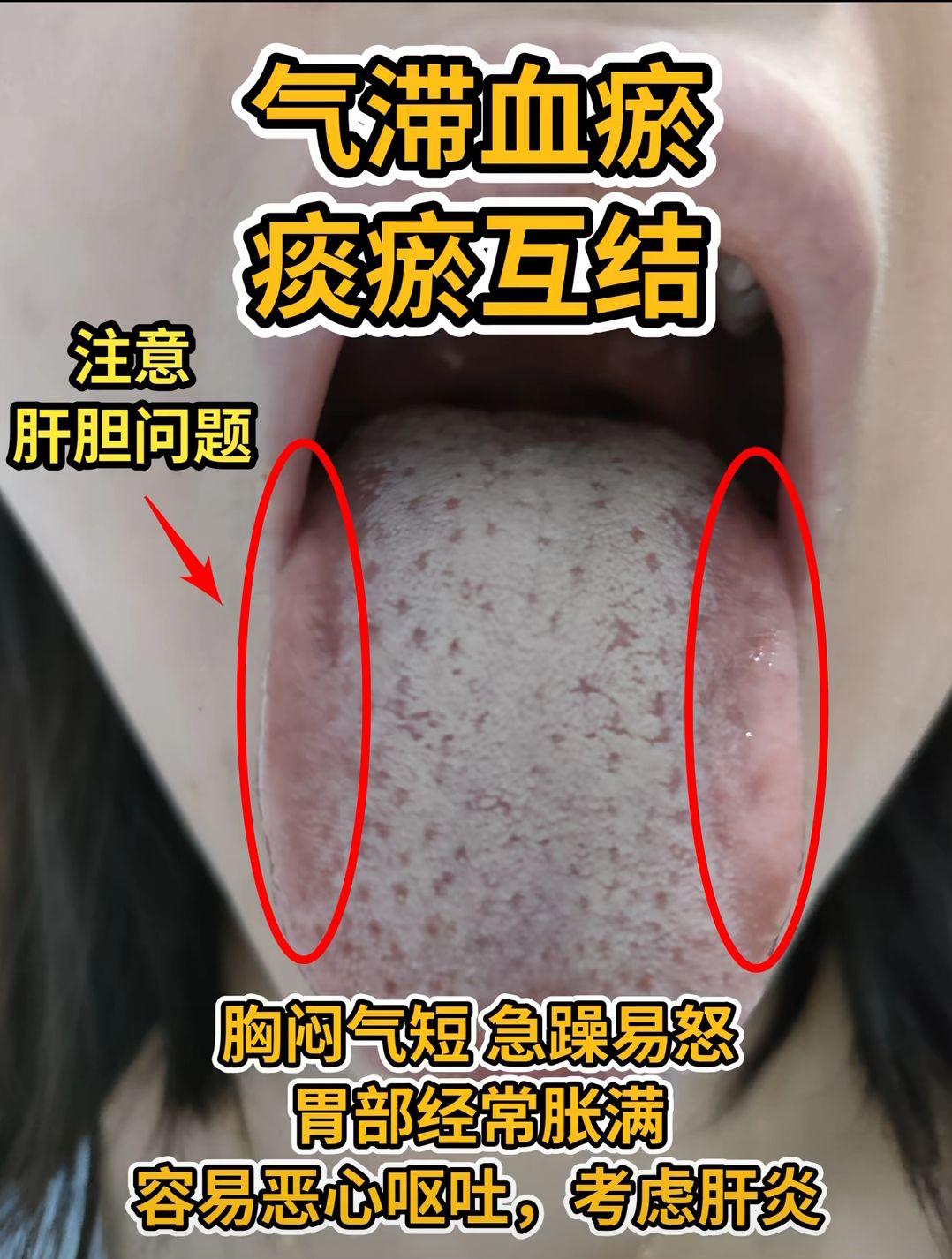 每日舌诊实战经验分享