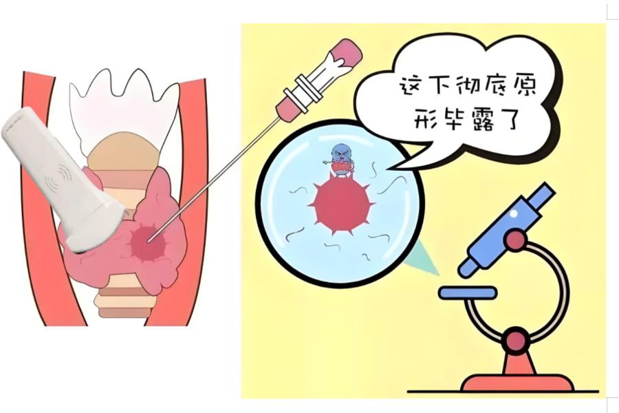 做骨髓穿刺是不是很可怕呢？

骨髓穿刺通常不会很可怕，多数情况下仅会有轻微不适感