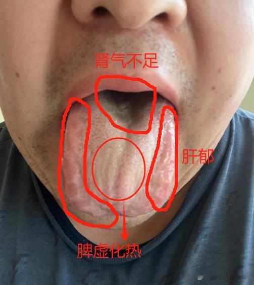 你才30来岁啊，真不知道你咋过的 ，身上没一点好地方[狗头][狗头][狗头]
主